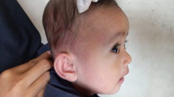 *Aksi Cepat Tanggap Sie Dokkes Polres Tuba Selamatkan Korban Laka Lantas di Cakat Raya: Polri Semakin Dicintai Masy